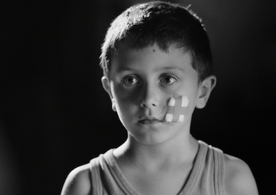 A child with a bandage on their face.
